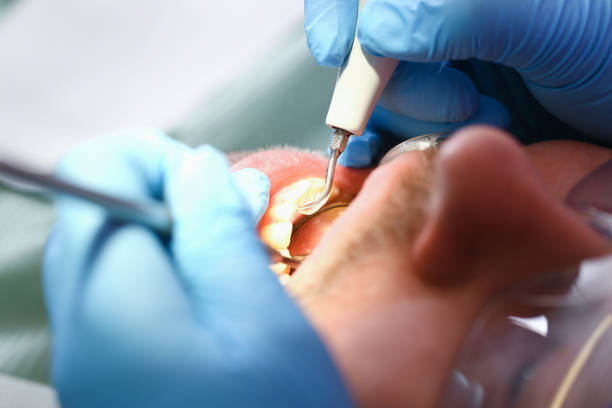 Best Dentist for Tooth Abscess  in Blackshear, GA