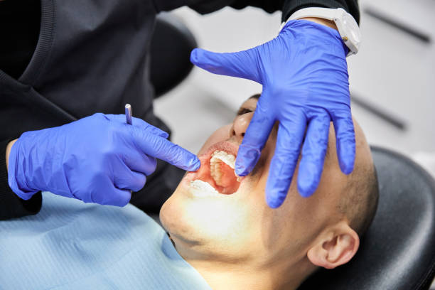 Best Knocked-Out Tooth Emergency  in Blackshear, GA